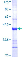 ab162629 on a 12.5% SDS-PAGE stained with Coomassie Blue.
