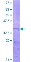 ab157919 on a 12.5% SDS-PAGE stained with Coomassie Blue.