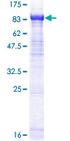 ab162770 on a 12.5% SDS-PAGE stained with Coomassie Blue.