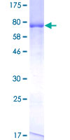 ab161682 on a 12.5% SDS-PAGE stained with Coomassie Blue.