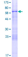 ab166022 on a 12.5% SDS-PAGE stained with Coomassie Blue.