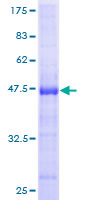 ab164205 on a 12.5% SDS-PAGE stained with Coomassie Blue.