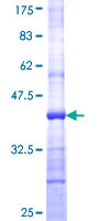 ab164206 on a 12.5% SDS-PAGE stained with Coomassie Blue.