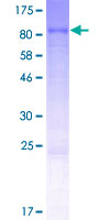 ab162201 on a 12.5% SDS-PAGE stained with Coomassie Blue.