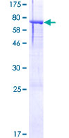 ab161581 on a 12.5% SDS-PAGE stained with Coomassie Blue.