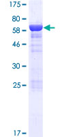ab165403 on a 12.5% SDS-PAGE stained with Coomassie Blue.