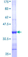ab165404 on a 12.5% SDS-PAGE stained with Coomassie Blue.
