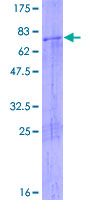 ab153302 on a 12.5% SDS-PAGE stained with Coomassie Blue.