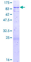 ab164451 on a 12.5% SDS-PAGE stained with Coomassie Blue.