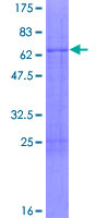 ab161432 on a 12.5% SDS-PAGE stained with Coomassie Blue.