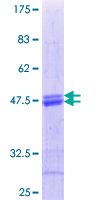 ab161433 on a 12.5% SDS-PAGE stained with Coomassie Blue.