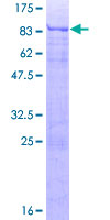 ab161243 on a 12.5% SDS-PAGE stained with Coomassie Blue.