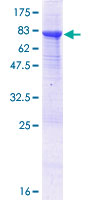 ab153559 on a 12.5% SDS-PAGE stained with Coomassie Blue.