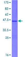 ab164720 on a 12.5% SDS-PAGE stained with Coomassie Blue.