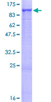 ab161122 on a 12.5% SDS-PAGE stained with Coomassie Blue.