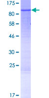 ab161123 on a 12.5% SDS-PAGE stained with Coomassie Blue.