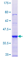 ab161124 on a 12.5% SDS-PAGE stained with Coomassie Blue.