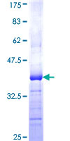 ab161629 on a 12.5% SDS-PAGE stained with Coomassie Blue.