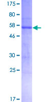ab157927 on a 12.5% SDS-PAGE stained with Coomassie Blue.