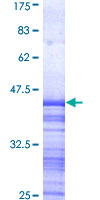 ab162058 on a 12.5% SDS-PAGE stained with Coomassie Blue.