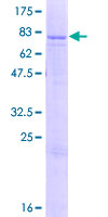 ab157931 on a 12.5% SDS-PAGE stained with Coomassie Blue.