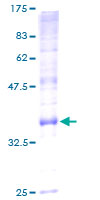 ab157935 on a 12.5% SDS-PAGE stained with Coomassie Blue.