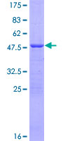 ab153084 on a 12.5% SDS-PAGE stained with Coomassie Blue.