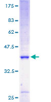 ab160543 on a 12.5% SDS-PAGE stained with Coomassie Blue.
