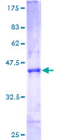 ab162080 on a 12.5% SDS-PAGE stained with Coomassie Blue.