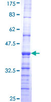 ab157948 on a 12.5% SDS-PAGE stained with Coomassie Blue.