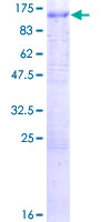 ab157945 on a 12.5% SDS-PAGE stained with Coomassie Blue.