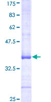 ab157946 on a 12.5% SDS-PAGE stained with Coomassie Blue.