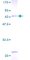 ab160342 on a 12.5% SDS-PAGE stained with Coomassie Blue.