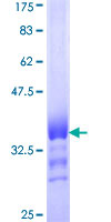 ab160343 on a 12.5% SDS-PAGE stained with Coomassie Blue.