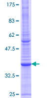 ab157940 on a 12.5% SDS-PAGE stained with Coomassie Blue.