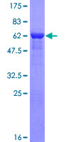 ab166008 on a 12.5% SDS-PAGE stained with Coomassie Blue.