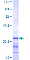 ab166009 on a 12.5% SDS-PAGE stained with Coomassie Blue.