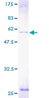 ab162536 on a 12.5% SDS-PAGE stained with Coomassie Blue.