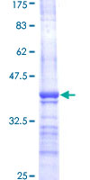 ab162537 on a 12.5% SDS-PAGE stained with Coomassie Blue.