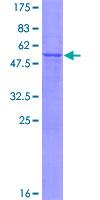 ab164825 on a 12.5% SDS-PAGE stained with Coomassie Blue.