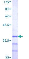 ab164826 on a 12.5% SDS-PAGE stained with Coomassie Blue.