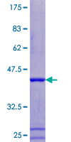 ab160420 on a 12.5% SDS-PAGE stained with Coomassie Blue.