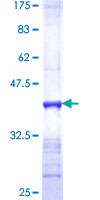 ab160421 on a 12.5% SDS-PAGE stained with Coomassie Blue.