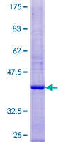ab165269 on a 12.5% SDS-PAGE stained with Coomassie Blue.