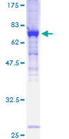 ab162611 on a 12.5% SDS-PAGE stained with Coomassie Blue.