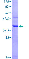 ab163868 on a 12.5% SDS-PAGE stained with Coomassie Blue.