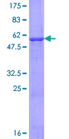 ab164870 on a 12.5% SDS-PAGE stained with Coomassie Blue.