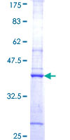 ab164871 on a 12.5% SDS-PAGE stained with Coomassie Blue.