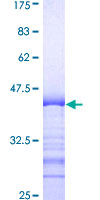 ab158316 on a 12.5% SDS-PAGE stained with Coomassie Blue.