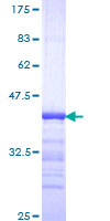 ab159476 on a 12.5% SDS-PAGE stained with Coomassie Blue.